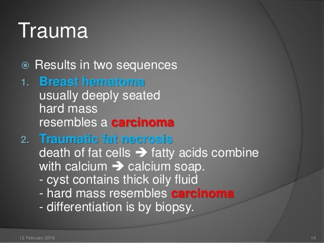 cysts in breast from trauma Cysts in breast from trauma